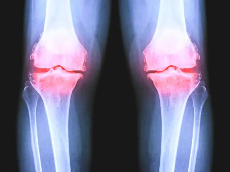 5 Non-Invasive Treatments for Knee Pain: Get Back on Your Feet Without Surgery